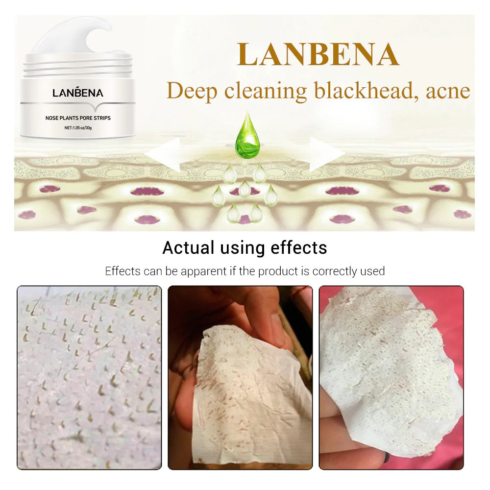 Snow Lotus Blackhead Removal Cream – Deep Cleansing & Moisturizing BeautyBond