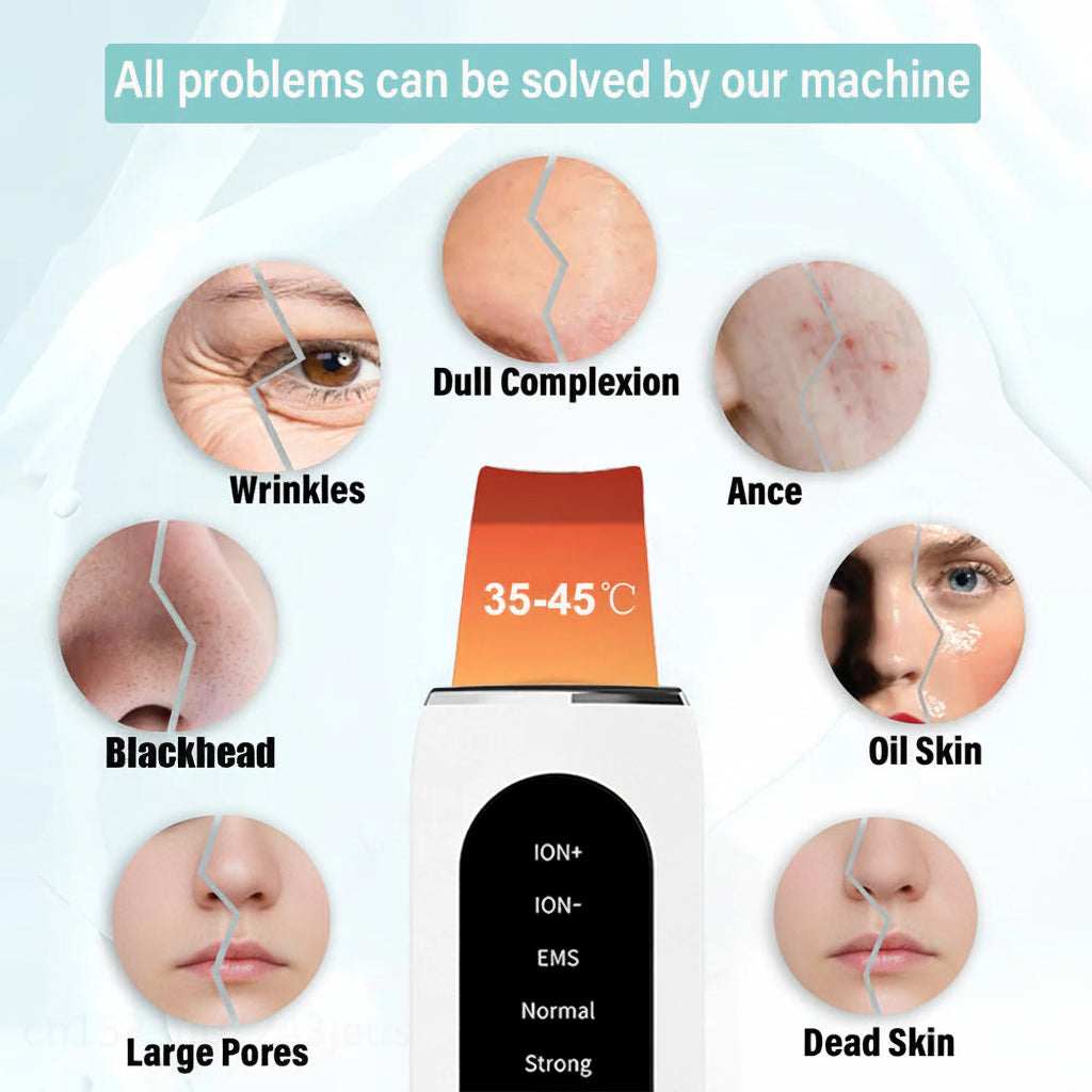Ultrasonic Skin Rejuvenator – LED Facial Scrubber & Blackhead Remover BeautyBond