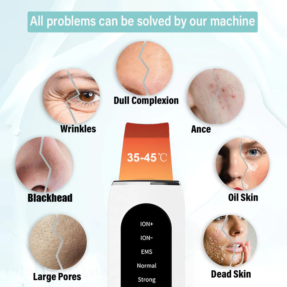 Radiant Skin Ultrasonic Rejuvenator