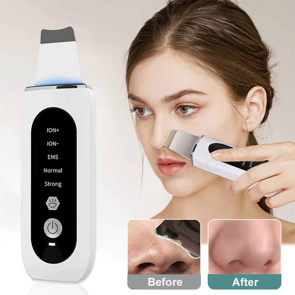 Ultrasonic Skin Rejuvenator – LED Facial Scrubber & Blackhead Remover BeautyBond