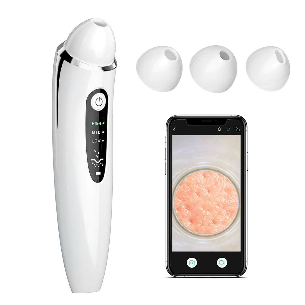 Ultrasonic Blackhead Remover – Electric Skin Scrubber & Pore Cleanser BeautyBond