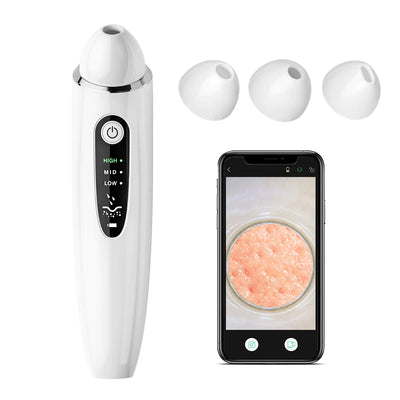 ClearSkin Ultrasonic Blackhead Remover