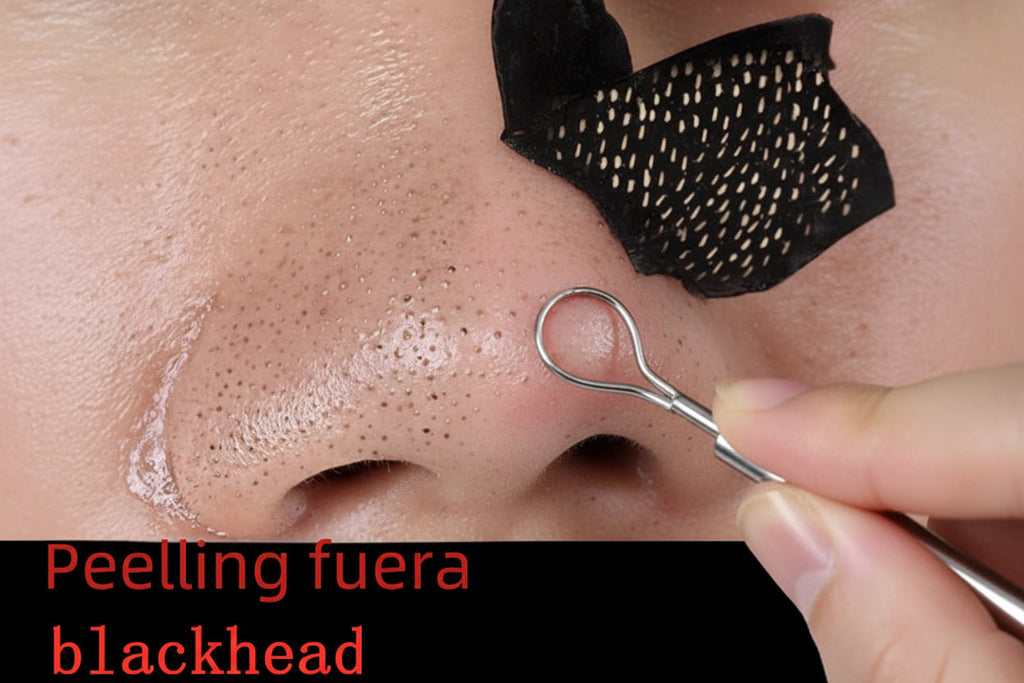 Blackhead Removal Nose Strips – Deep Cleansing Pore Mask (10-20 Pcs) BeautyBond