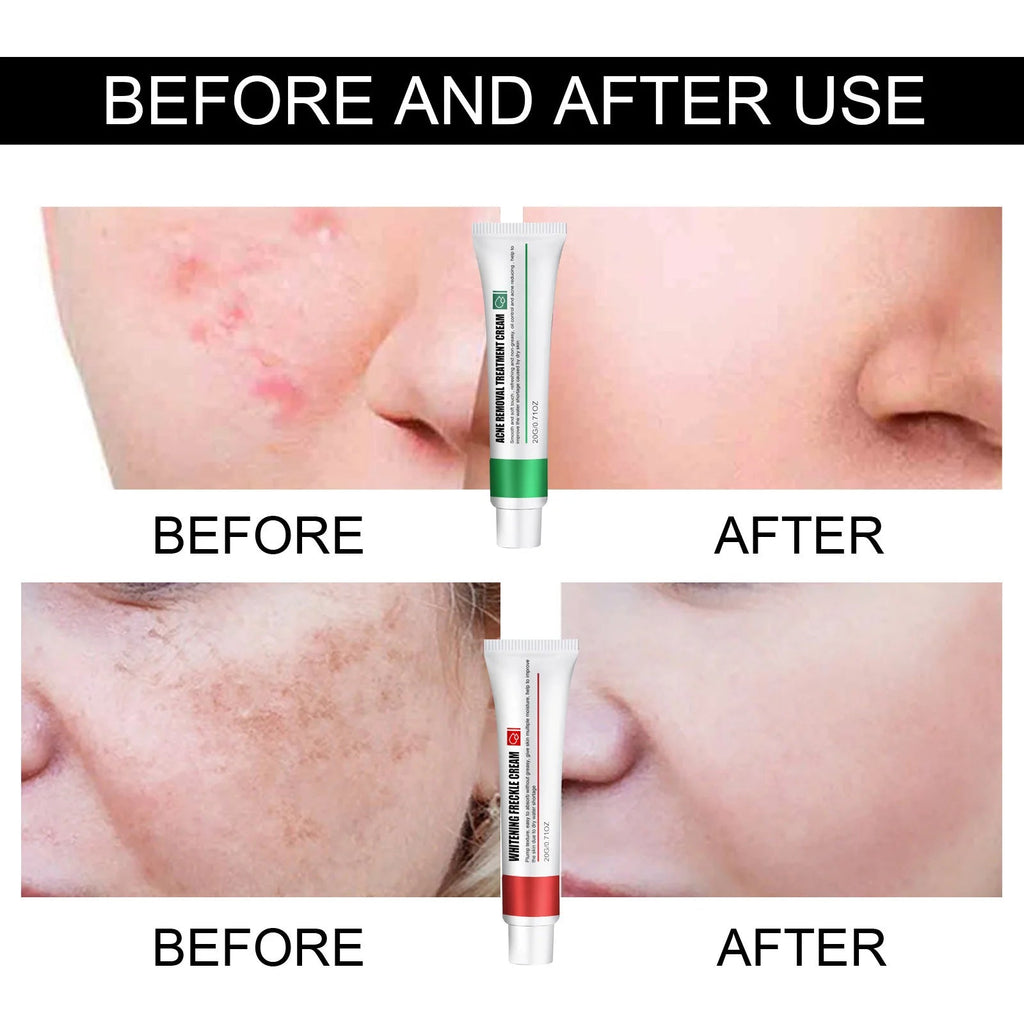 Skin Repair Cream Improves Dull Skin, Moisturizes and Cleanses Acne, Skin Repair and Care Cream BeautyBond