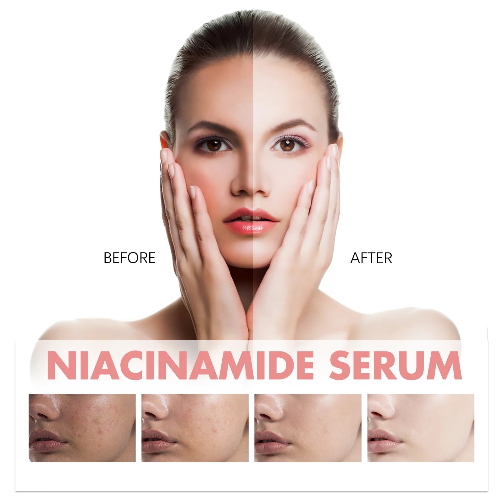 Niacinamide 10% Facial Serum — Pore Minimizing & Dark Spot Corrector BeautyBond