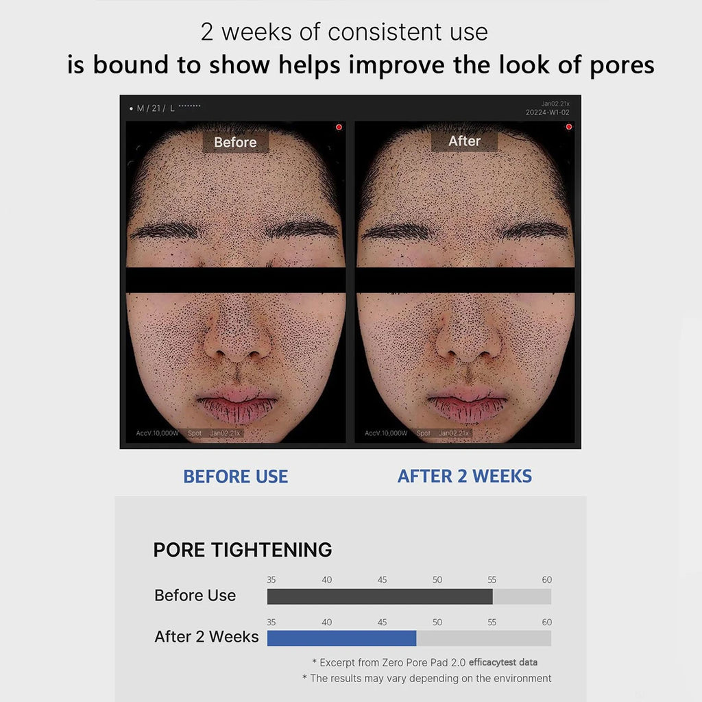 Medicube ZERO PORE PAD 2.0,Pre-Soaked Dual-Texture Cotton,Moisturizing & Calming Formula,Korean Skincare,K-Beauty,Korean Makeup BeautyBond