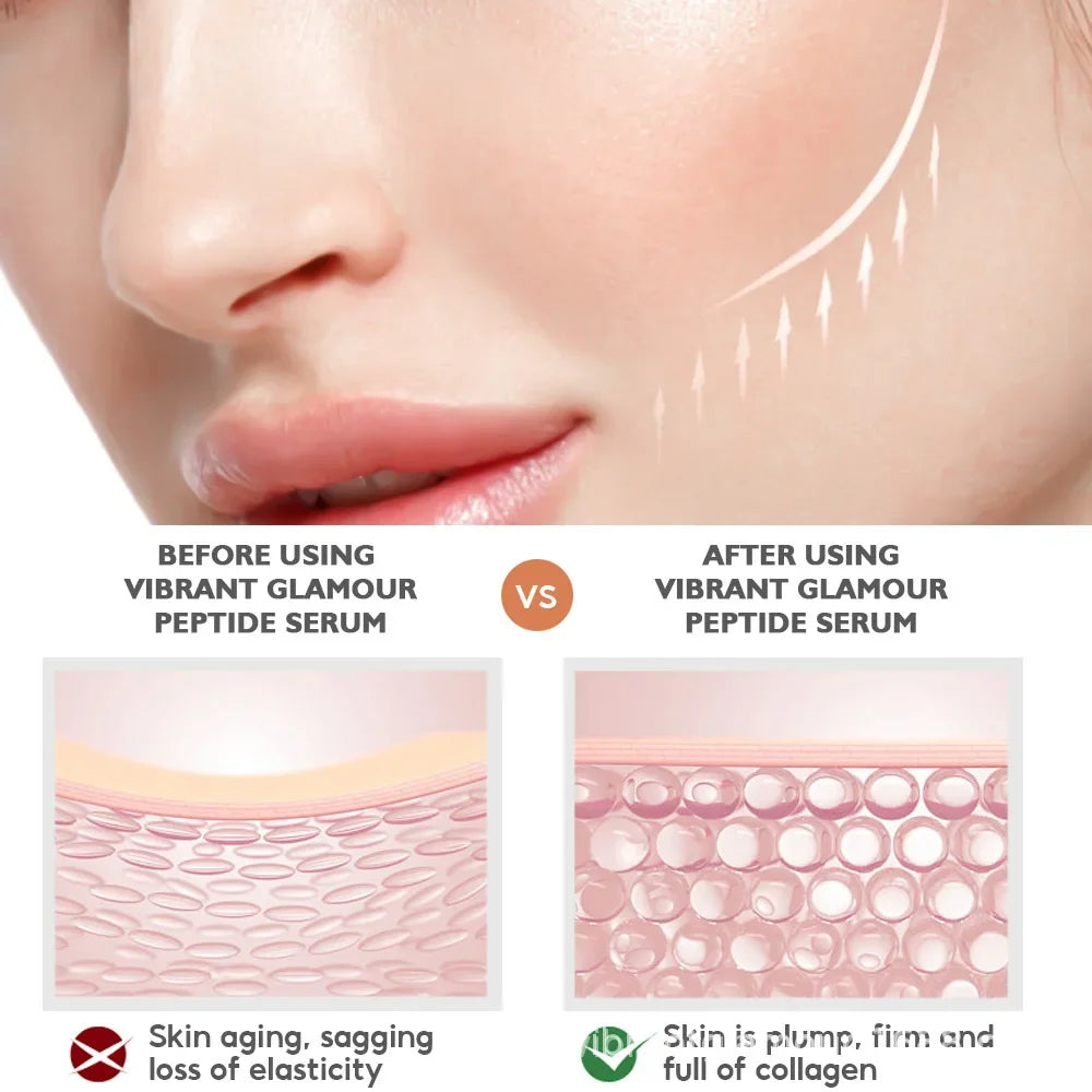 Peeling Serum Salicylic Acid Face Essence Shrink Pores Acne Treatment Removal Blackhead Melasma Whitening Facial Skin Care BeautyBond