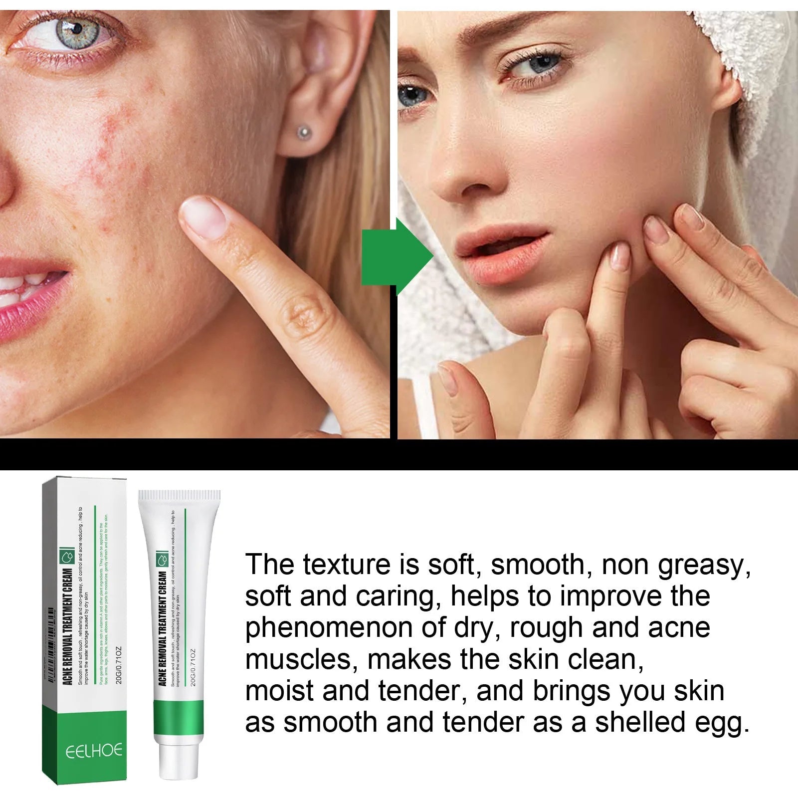 Skin Repair Cream Improves Dull Skin, Moisturizes and Cleanses Acne, Skin Repair and Care Cream BeautyBond