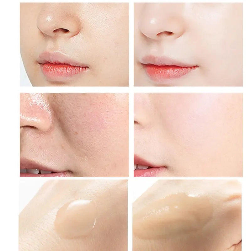 Peeling Serum Salicylic Acid Face Essence Shrink Pores Acne Treatment Removal Blackhead Melasma Whitening Facial Skin Care BeautyBond