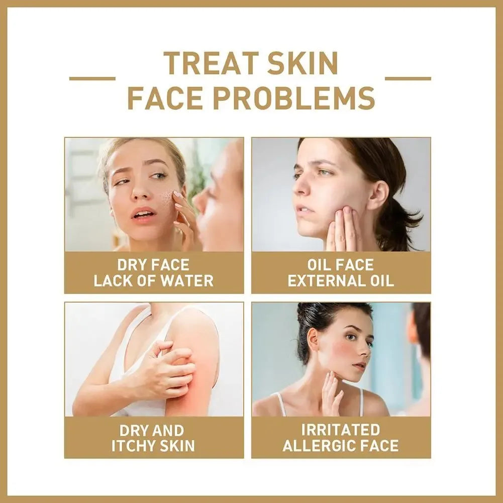 Rice Face Toner Moisturizing Water Brightening Lifting 150ml Deep Facial Cleanser For Young Glowy Korean Skin Care BeautyBond