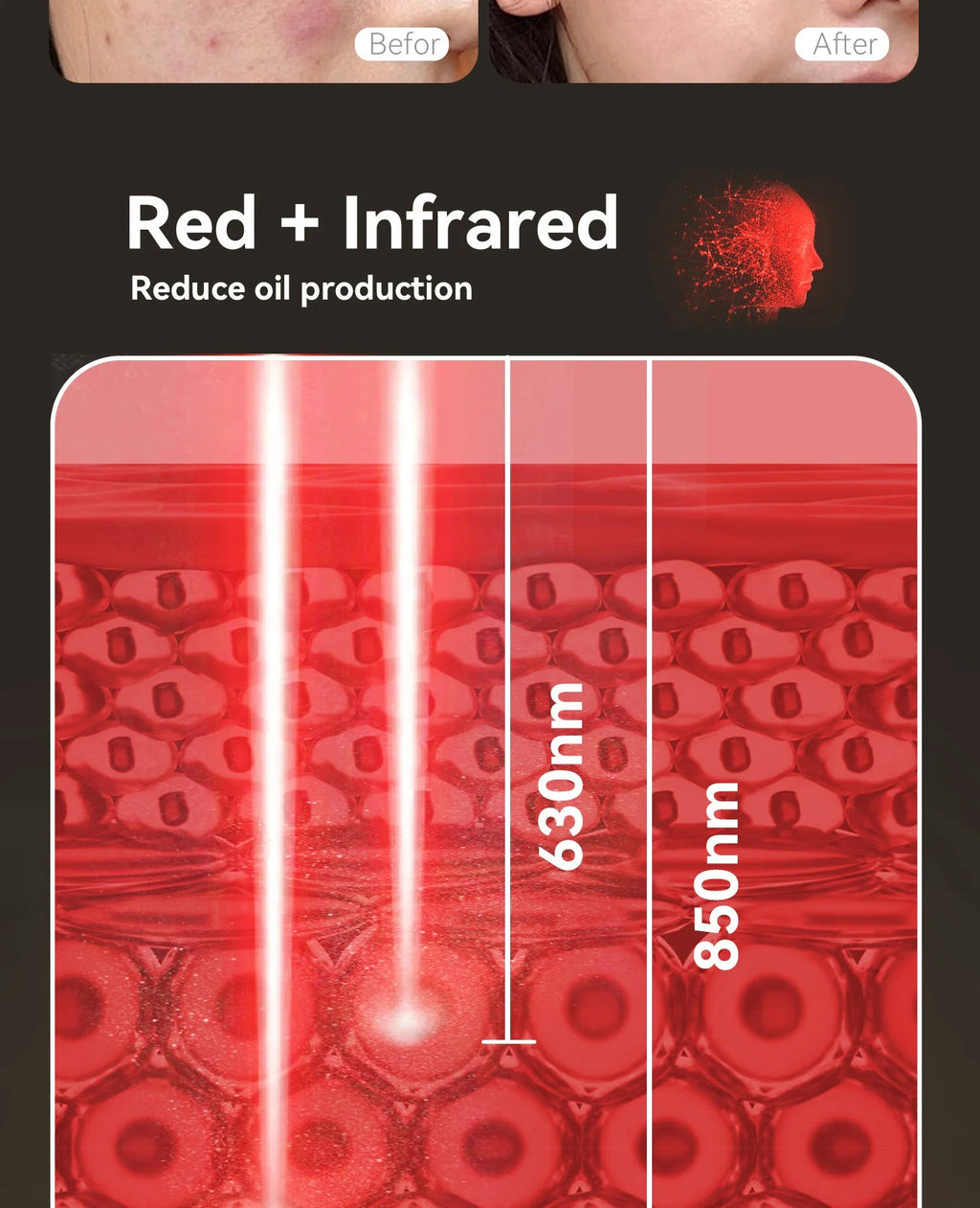 Hello Face Portable Red Infrared Blue LED Light Therapy Face Mask Acne Treatment, Skin Rejuvenation, Home Use for All Skin Types BeautyBond