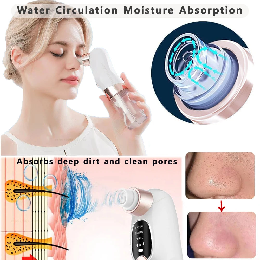 Blackhead Remover Pore Vacuum Face Cleaner Electric Pimple Acne Black Head Removal USB Rechargeable Water Cycle Black Dot Remove BeautyBond