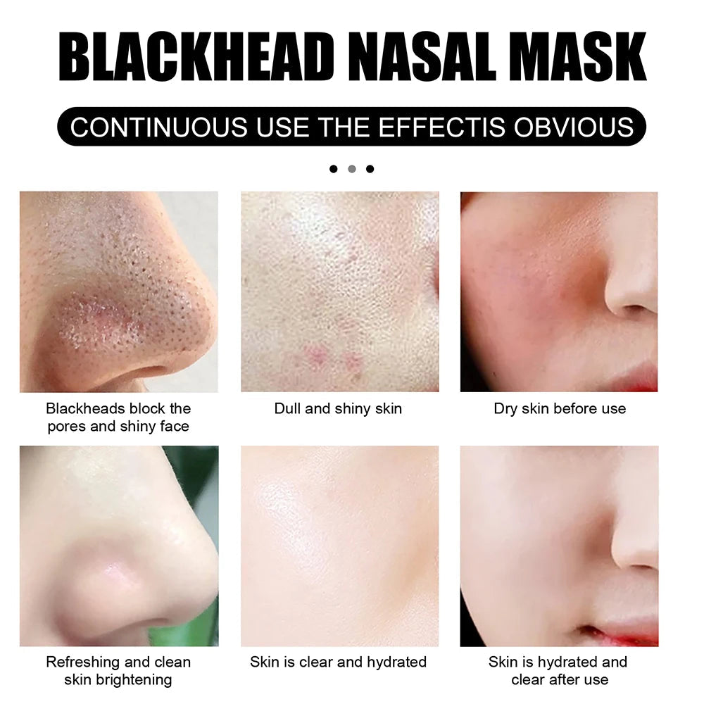 Blackhead Remover Mask Nose Mask Pore Strips Black Mask Peeling Acne Treatment Deep Cleansing Face Mask Oil Control Skin Care BeautyBond