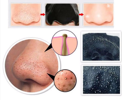 Charcoal Pore-Clearing Mask Set