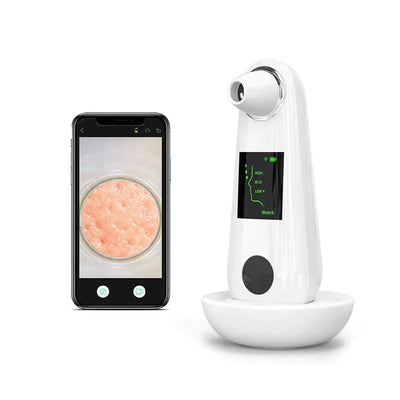 ClearSkin Ultrasonic Blackhead Remover