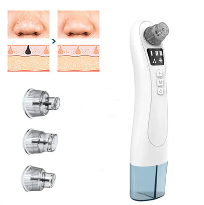 Ultrasonic ClearSkin Blackhead Extractor