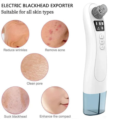 Ultrasonic ClearSkin Blackhead Extractor