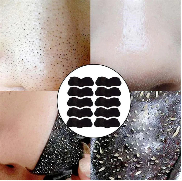Charcoal Blackhead Strips – Deep Cleansing Nose Pore Remover BeautyBond